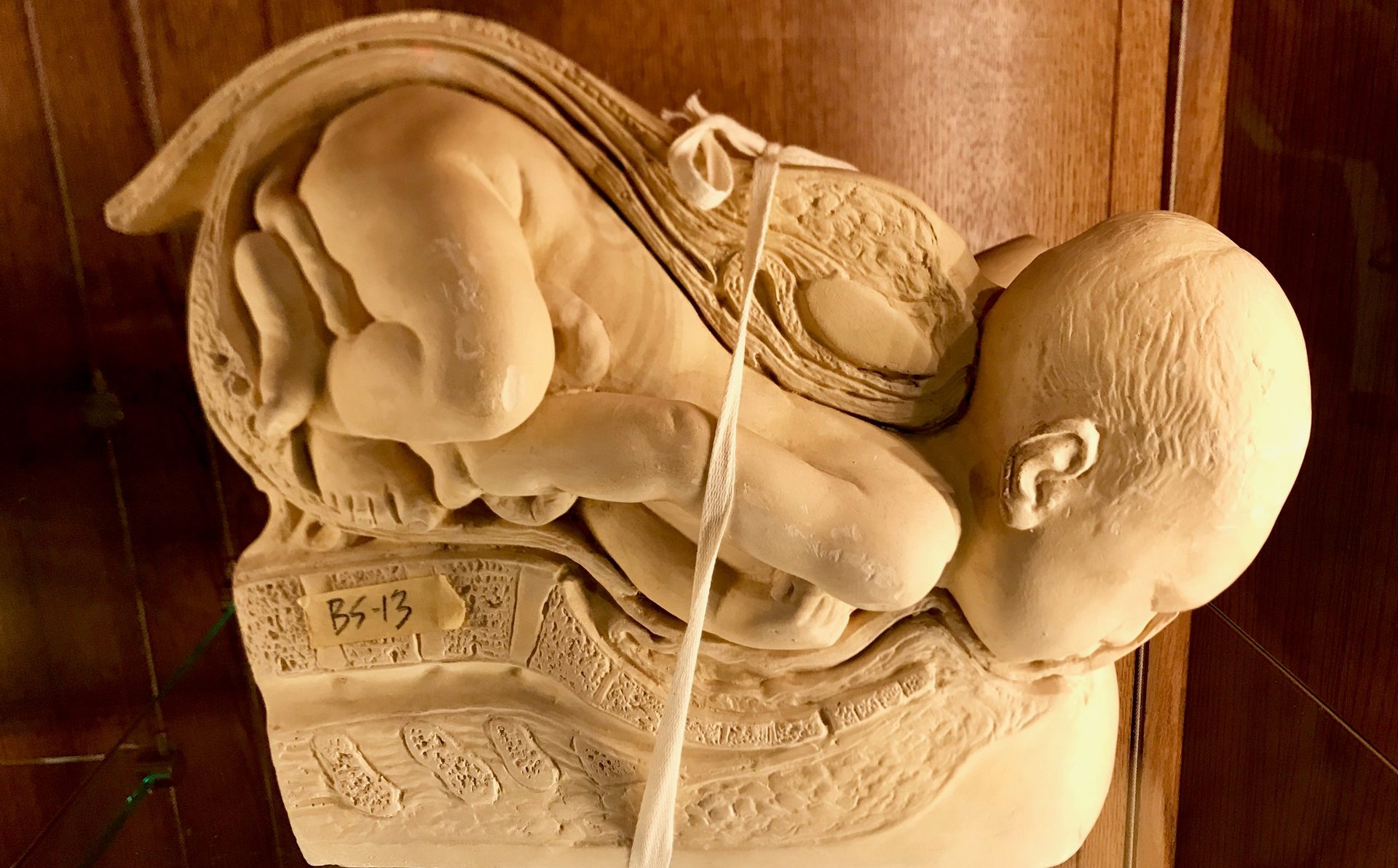 Dickinson-Belskie Collection, Warren Anatomical Museum, Boston (by Luca Ambrosio) (9).jpg